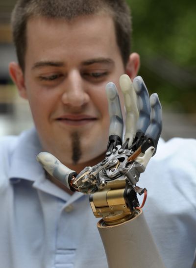 Christian Kandlbauer shows his arm prosthesis to the press in May 2008.  (Associated Press)