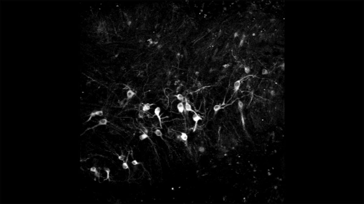 A still image from video provided by Pasca Lab at Stanford University shows clusters of human neurons that were transplanted into the brains of newborn rats. The striking feat of biological engineering may provide more realistic models for neurological conditions such as autism and serve as a way to restore injured brains. (Pasca Lab/Stanford University via The New York Times) -- NO SALES; FOR EDITORIAL USE ONLY WITH NYT STORY SLUGGED SCI HUMAN CELLS RATS BY ZACHARY SMALL FOR OCT. 7, 2022. ALL OTHER USE PROHIBITED. -- (PASCA LAB/STANFORD UNIVERSITY)