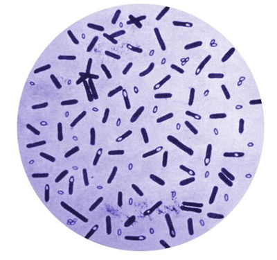 Clostridium botulinum can be found in soil, water and even honey.  (Centers for Disease Control and Prevention)