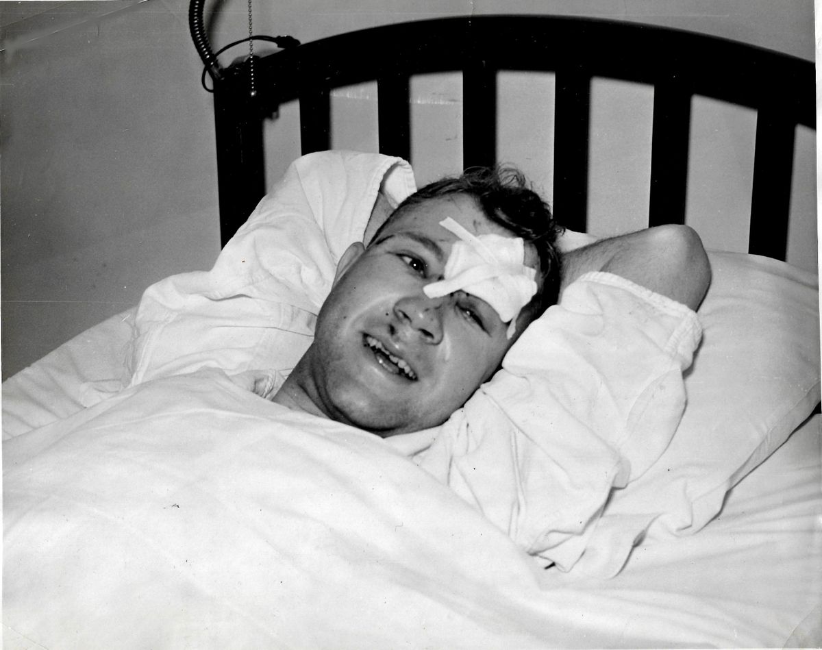 Co-pilot Dwight A. Hansen is seen recovering at a hospital after a United Airlines Boeing 247 plane crashed in the Cascades in 1934. Hansen hiked off the mountain to seek help while the captain and passengers stayed behind. Hansen suffered a skull fracture, a broken nose, shock, cuts and bruises and the loss of several teeth. (ACME Photo / Courtesy of Darin Z. Krogh)