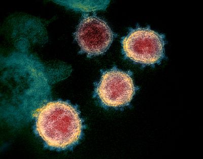 This electron microscope image made available by the U.S. National Institutes of Health in February shows the virus that causes COVID-19. The sample was isolated from a patient in the U.S. (National Institute of Allergy and Infectious Diseases)