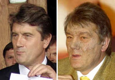 
Ukraine opposition leader Viktor Yushchenko is shown at left on July 4, before his illness, and on Friday. Doctors said his illness was caused by dioxin poisoning. 
 (Associated Press / The Spokesman-Review)