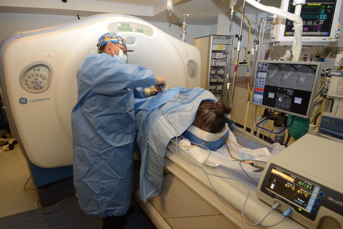 The procedure STAR, or spinal tumor ablation radiofrequency, goes directly into afflicted vertebrae with a specially designed instrument that destroys tumors with radiofrequency energy. The resulting void is then filled with a special stabilizing procedure. (Courtesy Knight)
