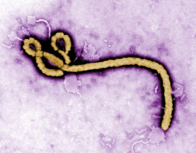 FILE - In this undated colorized transmission electron micrograph file image made available by the CDC shows an Ebola virus virion. Health authorities are investigating nine suspected cases of Ebola in a remote corner of northern Congo, including two deaths, the country's health minister said Friday May 12, 2017. (Frederick Murphy/CDC via AP, File) ORG XMIT: XJD101 (Frederick Murphy / AP)