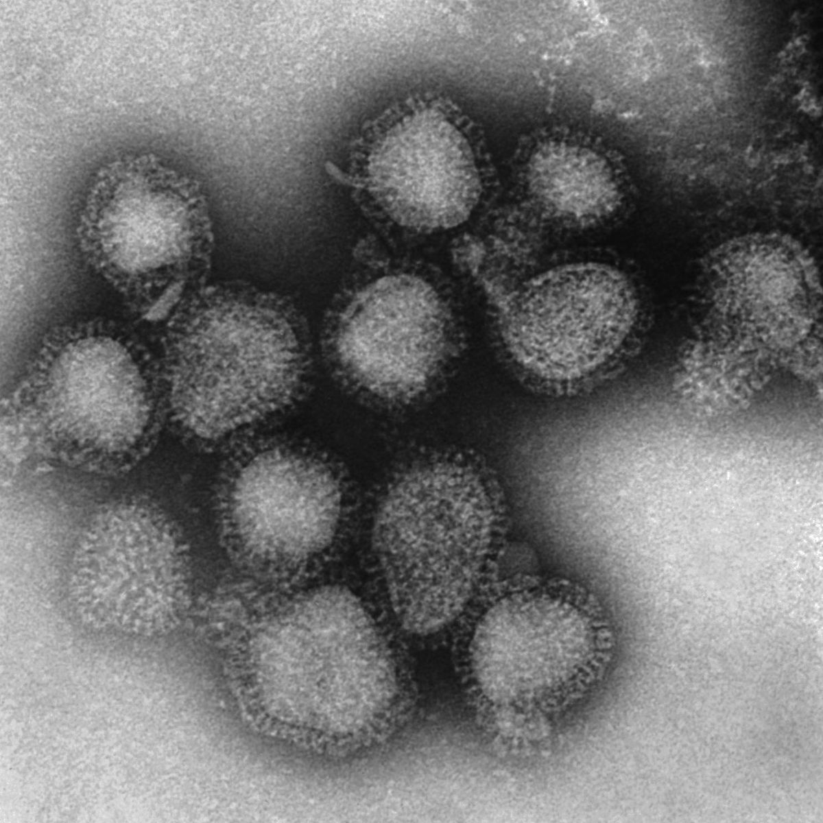 This 1975 electron microscope image made available by the Centers for Disease Control and Prevention shows a group of H3N2 influenza A virus virions. On Friday, March 8, 2019, health officials said there’s a strong chance this flu season has peaked, but are watching a recent wave of illnesses from H3N2, a nastier flu strain. (Fred Murphy / AP)