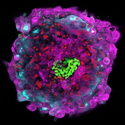 This microscope photo provided by The Rockefeller University shows a human embryo 12 days after fertilization in vitro, with different cell types marked by separate colors. (Gist Croft, Alessia Deglincerti, Ali H. Brivanlou / Associated Press)