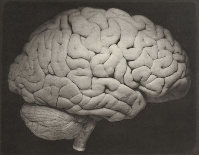 This 1885 photo shows a side view of a human brain. (Oscar G. Mason / Associated Press)