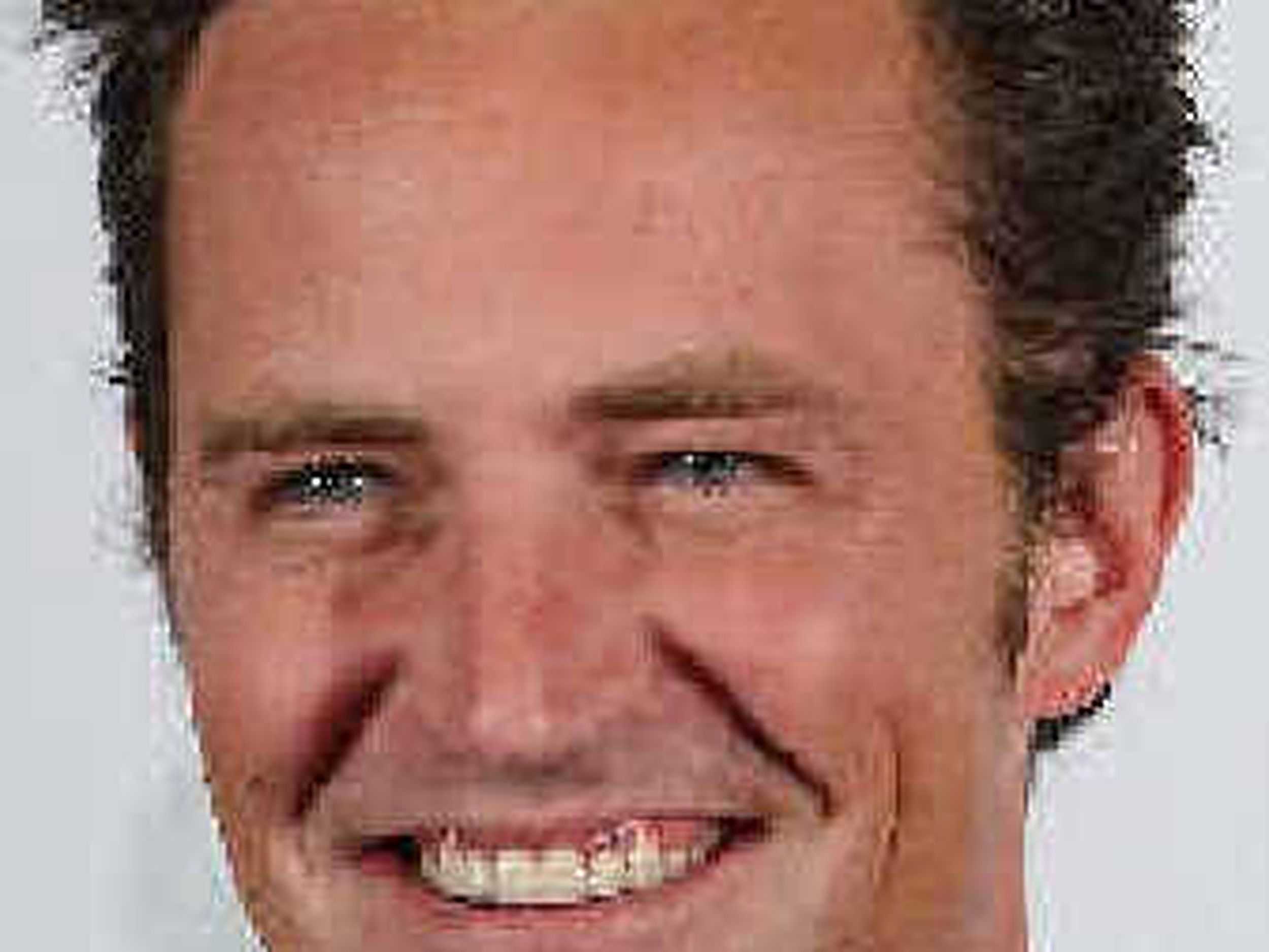 matthew perry friends season 1 teeth