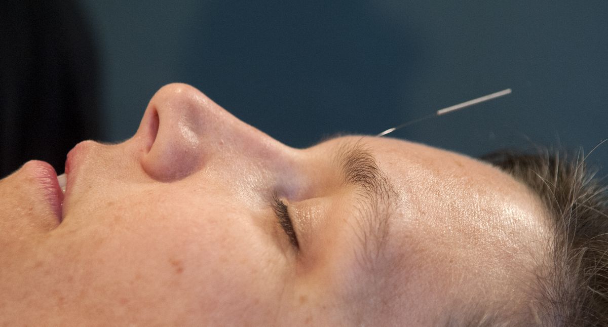 Amy Shook receives an acupuncture treatment from Rebekah Giangreco at New Moon Family Wellness Center in Spokane. (Dan Pelle)