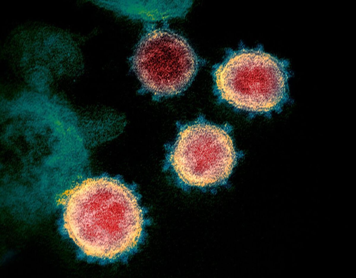 This undated electron microscope image made available by the U.S. National Institutes of Health in February 2020 shows the Novel Coronavirus SARS-CoV-2. Also known as 2019-nCoV, the virus causes COVID-19.   (HOGP)