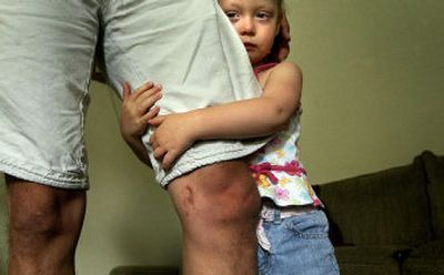 
Amaya Anderson, 2, hugs the leg of her father, Ian, who was shot several times in his legs while on a tour of duty in Iraq with the 1st Marine Division. 
 (Brian Plonka photos/ / The Spokesman-Review)