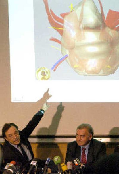 
French surgeon Bernard Devauchelle, left, points to a sketch as surgeon Jean-Michel Dubernard looks on during a press conference in Lyon, central France, on Friday  regarding the world's first partial face transplant. 
 (Associated Press / The Spokesman-Review)