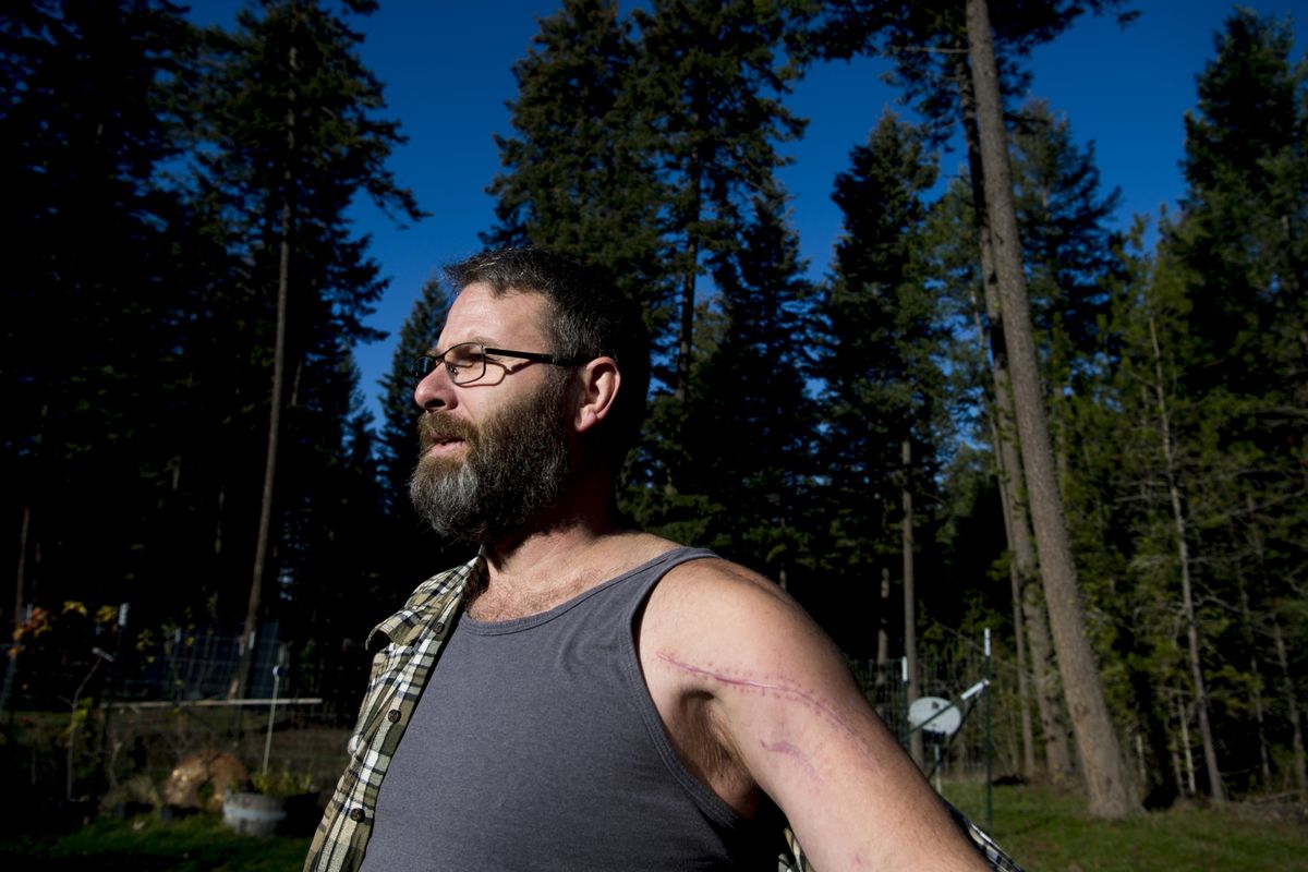 Luke McDonald, who was shot twice while trying to stop a bank robber in April, poses for a photo showing the scar on his shoulder on Thursday, Nov 20, 2016, at his home near Elk, Wash. (Tyler Tjomsland / The Spokesman-Review)