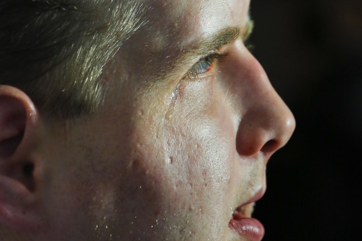 Former Mississippi firefighter Patrick Hardison, 42, gets teary-eyed under television lights, during a news conference marking one year after his face transplant on Wednesday Aug. 24, 2016, at New York University Langone Medical Center in New York. Hardison, who has light-sensitive eyes as his new face continues to thrive, was disfigured while trying to save people from a house fire in 2001 and received the face of a Brooklyn cyclist who died in an accident in July 2015. (Bebeto Matthews / Associated Press)