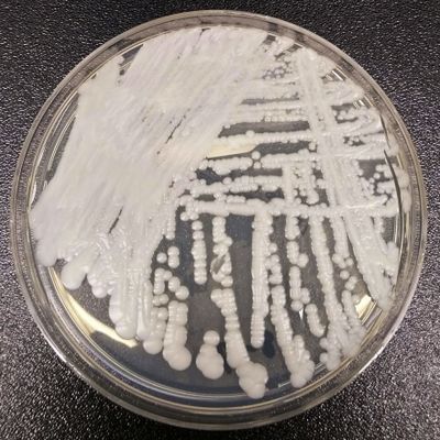 FILE - This 2016 photo made available by the Centers for Disease Control and Prevention shows a strain of Candida auris cultured in a petri dish at a CDC laboratory. On Thursday, July 22, 2021, the CDC said they now have evidence of the untreatable fungus spreading in a Washington, D.C, nursing home and at two Dallas-area hospitals. (Shawn Lockhart)