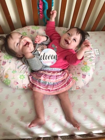 Conjoined twins Callie and Carter Torres in their crib in Blackfoot, Idaho. (Idaho State Journal)