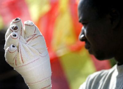 
An injured African immigrant waits in a holding facility in a Spanish enclave Saturday. Hundreds tried to scale fences last week to reach Spanish territory. 
 (Associated Press / The Spokesman-Review)