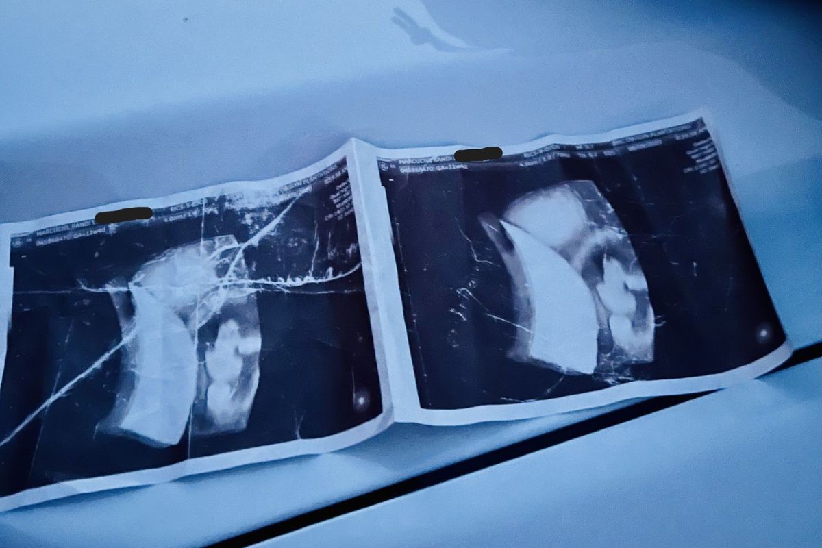 Two sonograms from Randi Marcucio’s 2020 ultrasound were found floating in the surf on Compo Beach in Westport, Conn. The Washington Post has redacted some personal information from this photo. 