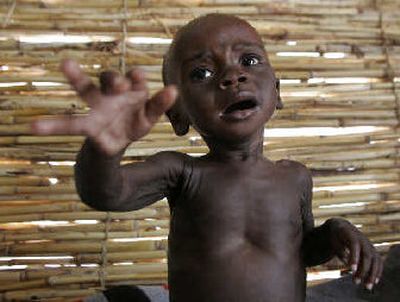 
A boy suffering from malnutrition struggles to sit up in a makeshift hospital in Maradi. About 800,000 children under 5 in Niger are suffering from hunger, including 150,000 who are facing severe malnutrition. 
 (The Spokesman-Review)