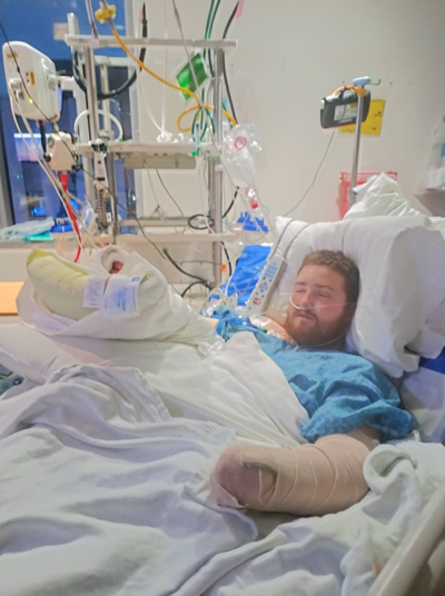 Justin Vickery lies a bed in the Harborview Medical Center following surgery on his arms. Photo from Christa Hunter’s Facebook page. 