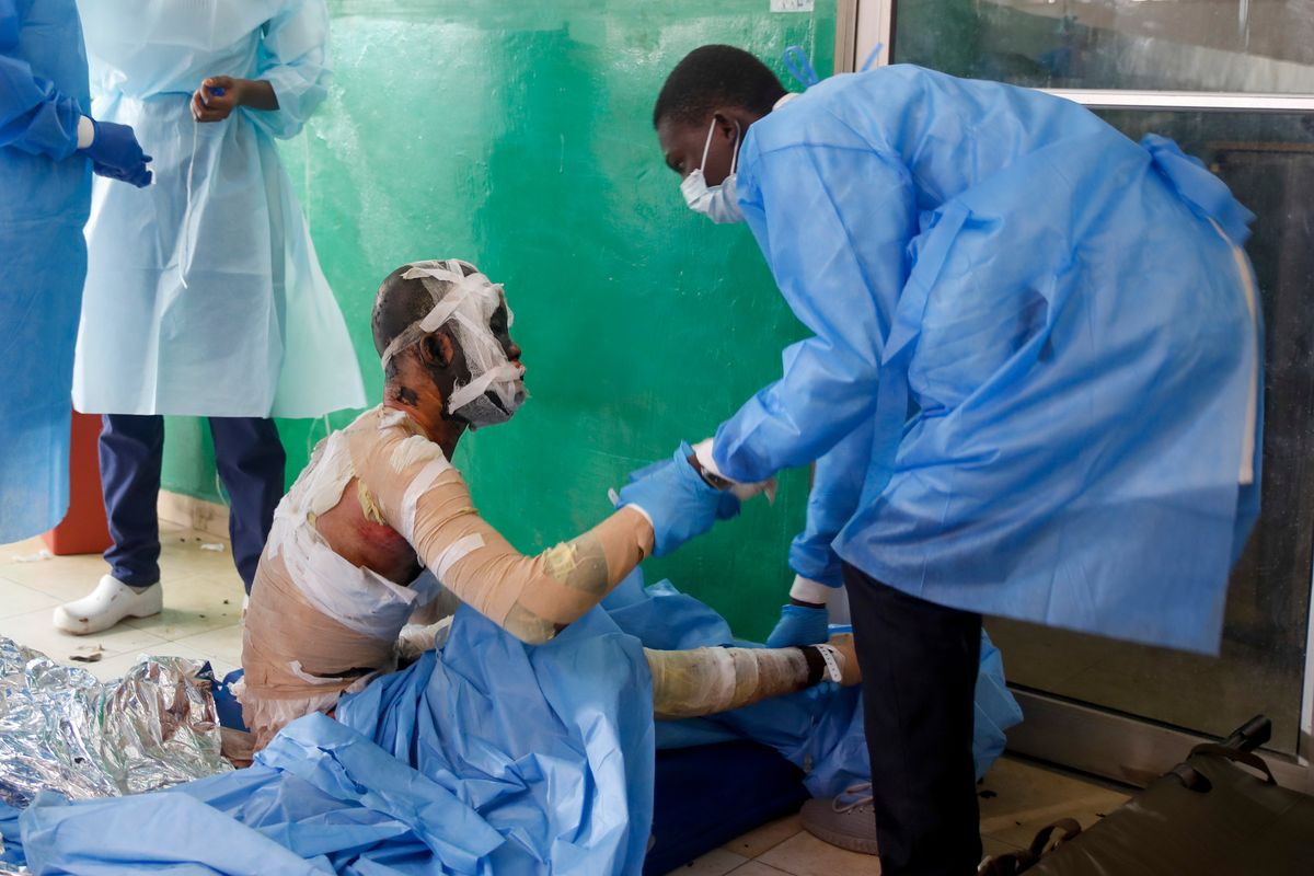 A health worker attends a man burned after a gasoline truck overturned and exploded, at the Justinien University Hospital in Cap-Haitien, Haiti, Tuesday, Dec. 14, 2021. The explosion engulfed cars and homes in flames, killing more than 50 people and injuring dozens of others. (Odelyn Joseph)