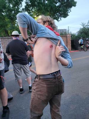 Harris Kahler muestra donde la policía le disparó con una bala de goma. "Tengo mucho dolor, pero si tengo que estar físicamente aquí, seré el escudo que tengo que ser." (Corbin Vanderby/The Spokesman-Review)