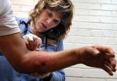 
Sandy Forsman, family nurse practitioner with the Spokane People's Clinics, checks swelling from a dog bite on Michael Sumner's arm on Monday in Spokane. 
 (Jed Conklin / The Spokesman-Review)