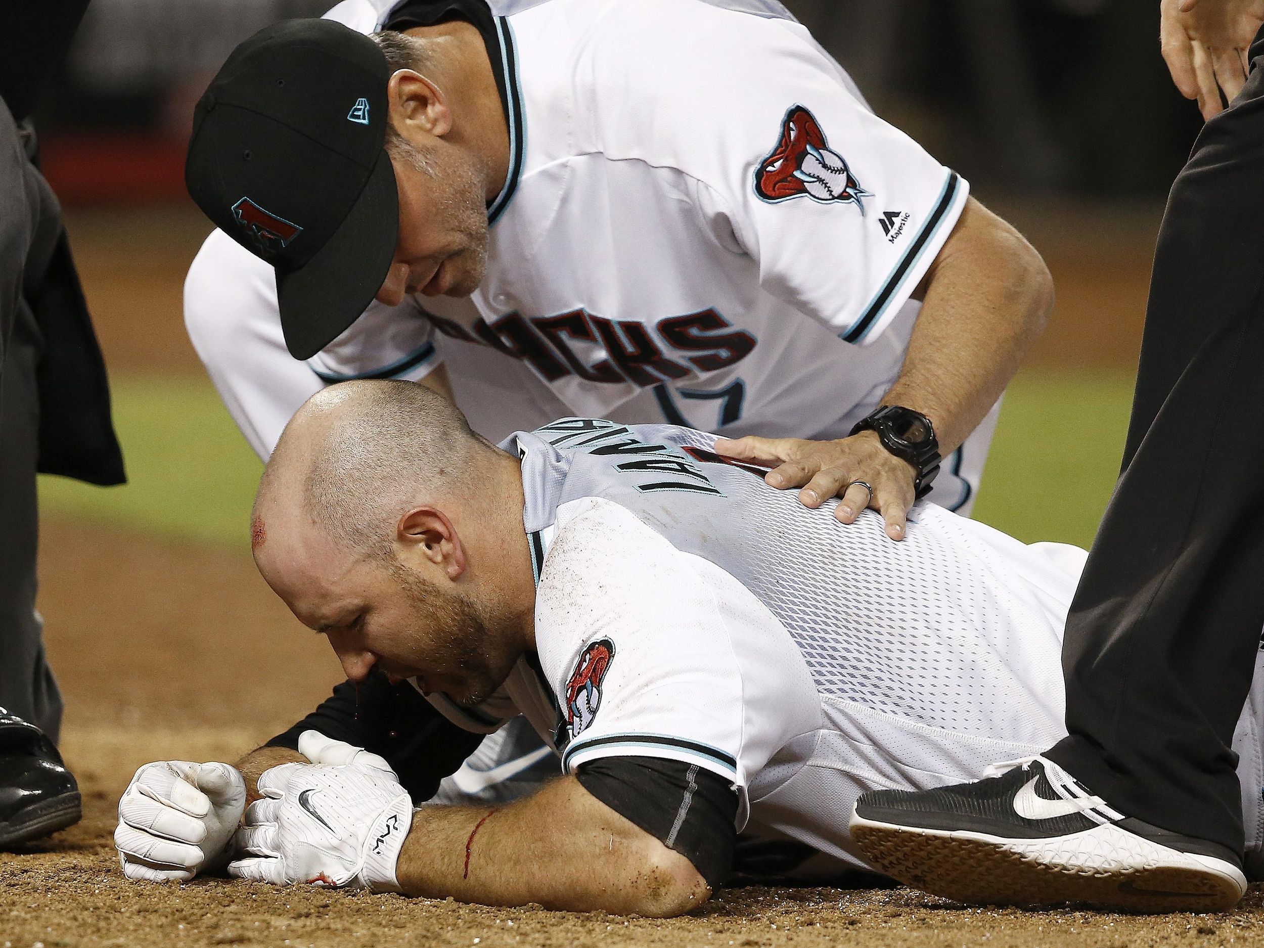 Diamondbacks' Chris Iannetta sent to hospital after getting hit in mouth by  pitch 