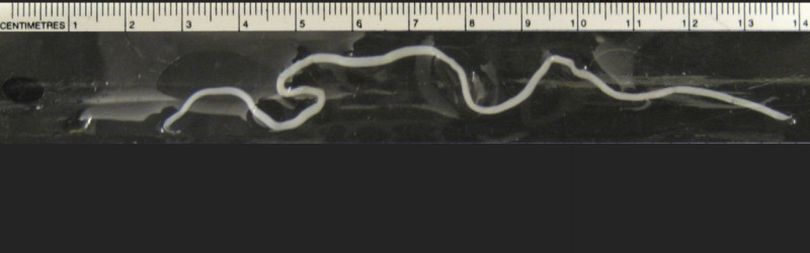 When Cornell University veterinarians found half-foot-long worms living in their feline patients in 2013, they had discovered something new: The worms, Dracunculus insignis, are common in wildlife but they had never before been seen in cats. (Cornell University)