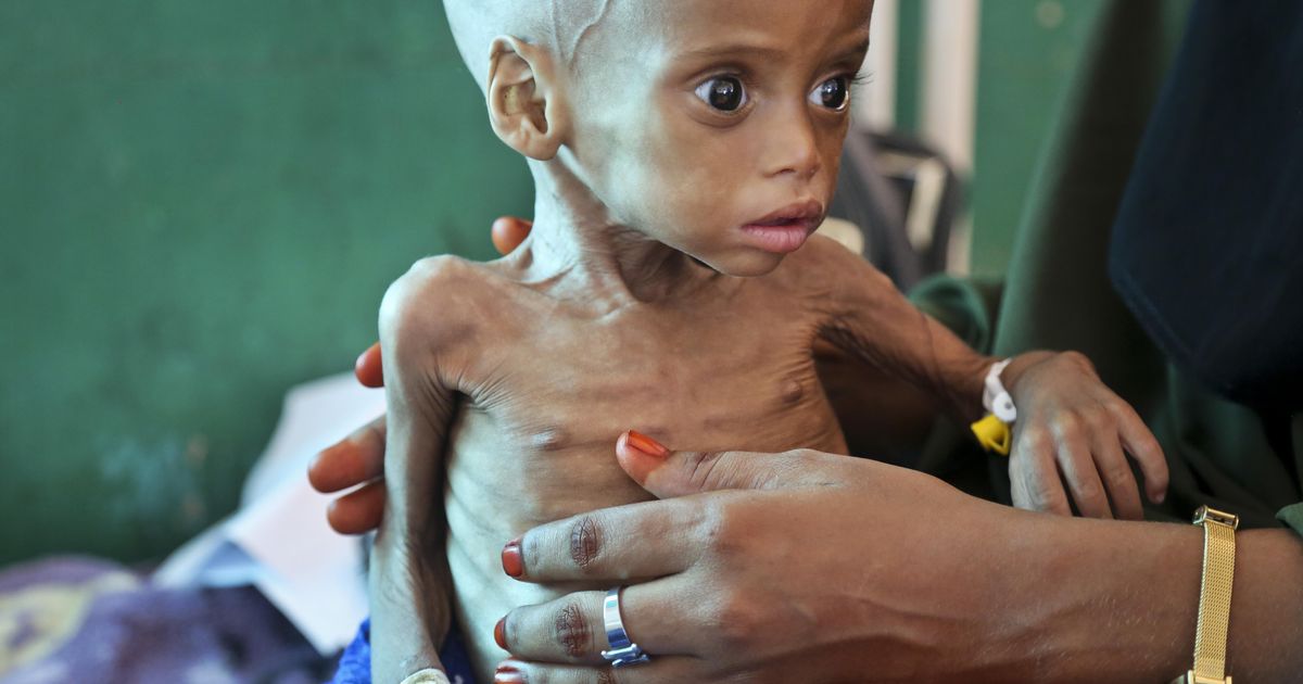 Yemen is on the brink of a horrible famine – here’s how things got so ...