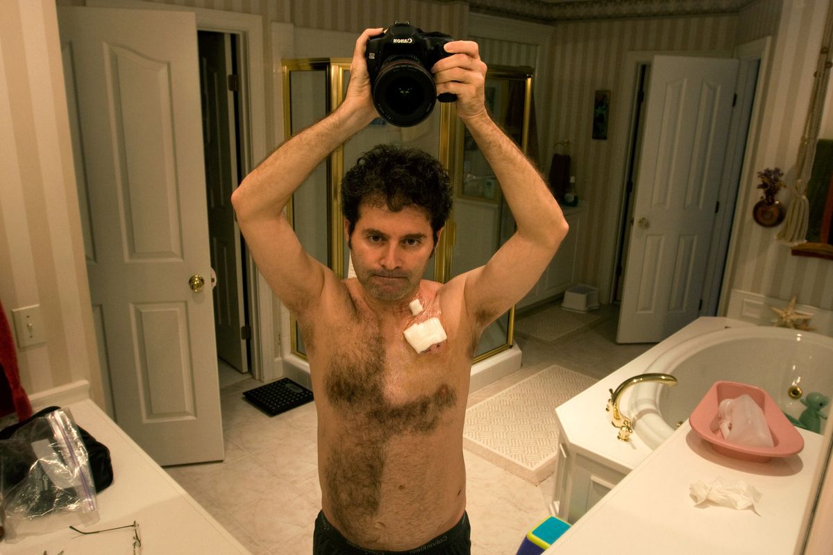 Following two surgeries and an unexpected lymphoma diagnosis, Kaplan says his film project began by accident when he decided to take a self-portrait in his bathroom mirror. Below: Kaplan chronicles his chemotherapy treatments and side effects in the documentary, but he doesn’t focus on them exclusively. There’s also humor and a few surprises along the way.