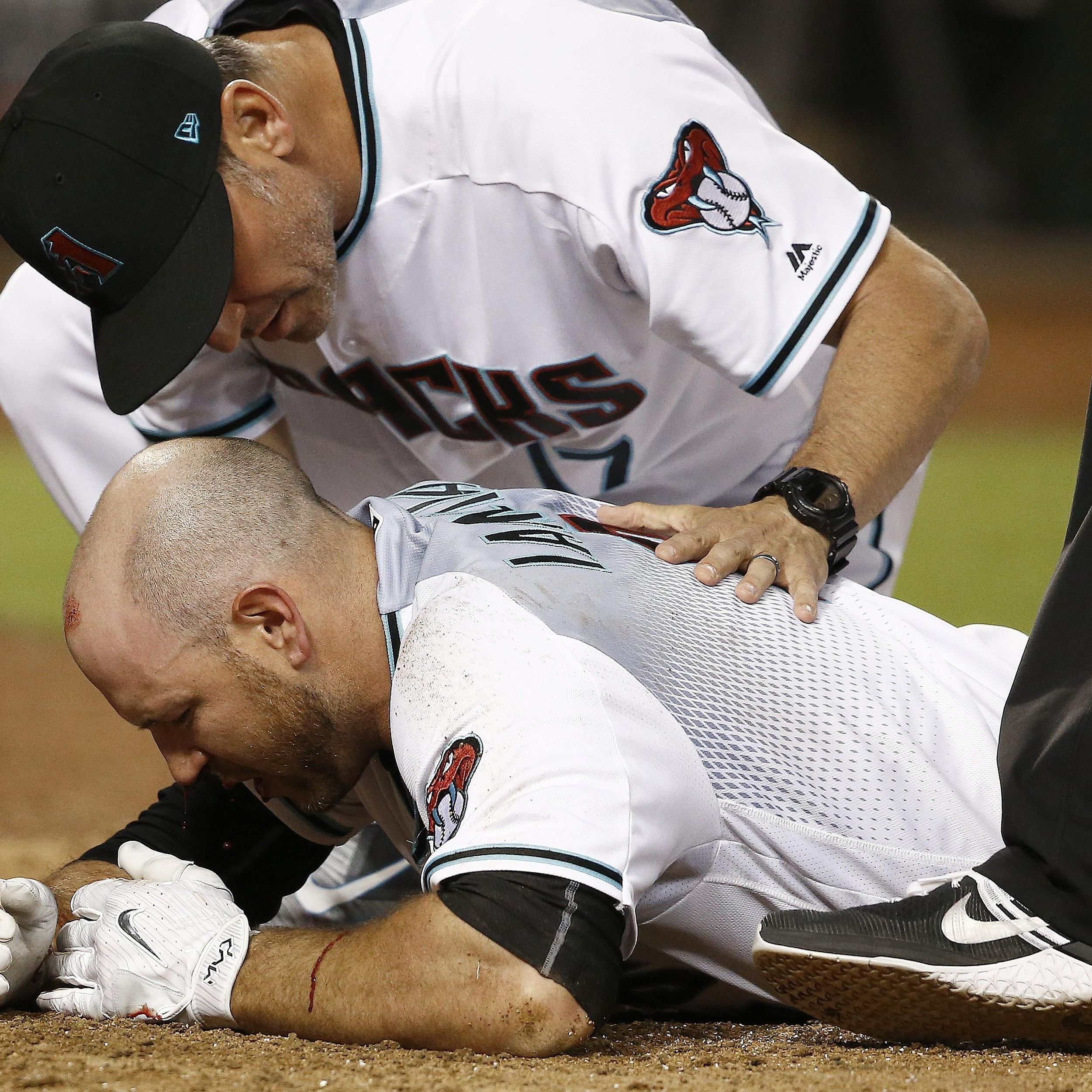 D-Backs' Chris Iannetta hit in face by pitch