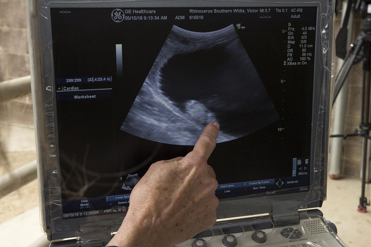 This May 15, 2018, photo provided by San Diego Zoo Global shows a researcher pointing to the newest ultrasound of Victoria, a southern white female rhino at the San Diego Zoo Safari Park in Escondido, Calif. The picture confirms what they’ve suspected for the past few weeks: she’s pregnant. The rhino has become pregnant through artificial insemination at the zoo giving hope for efforts to save a subspecies of one of the world’s most recognizable animals, researchers announce. (Tammy Spratt / AP)