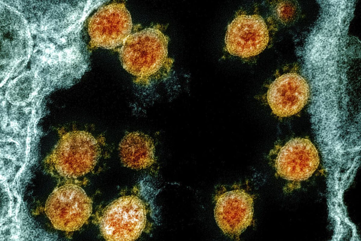 This electron microscope image made available and color-enhanced by the National Institute of Allergy and Infectious Diseases Integrated Research Facility in Fort Detrick, Md., shows Novel Coronavirus SARS-CoV-2 virus particles.   (HOGP)