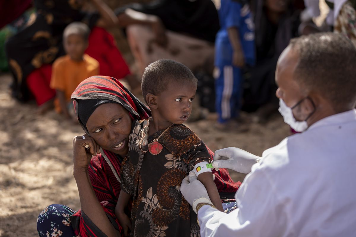 A nurse measures the arm of Nimo Abdi, who is suffering from diarrhea and vomiting and is receiving treatment for malnutrition, as she is held by her mother Shamis Dhire, at a UNICEF-supported mobile clinic at Barare village in the Higloley Woreda of the Somali region of Ethiopia Thursday, Jan. 20, 2022. In Ethiopia