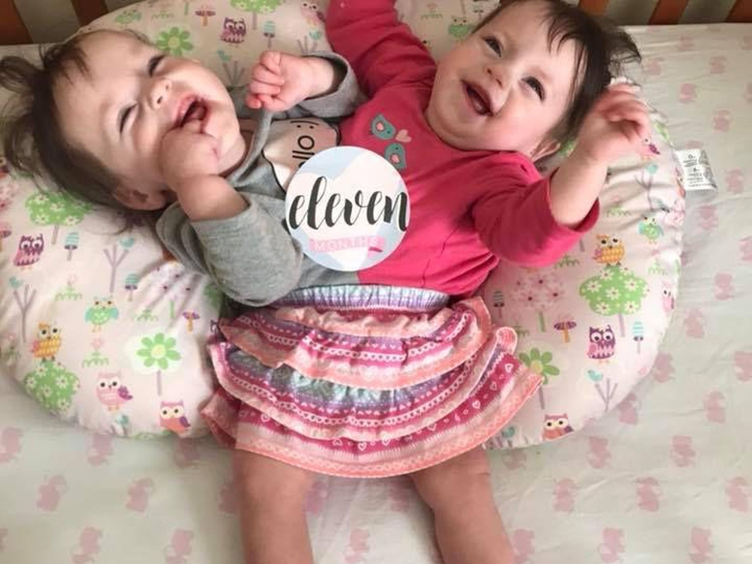 Conjoined Twins In Blackfoot Continue To Beat The Odds The Spokesman Review