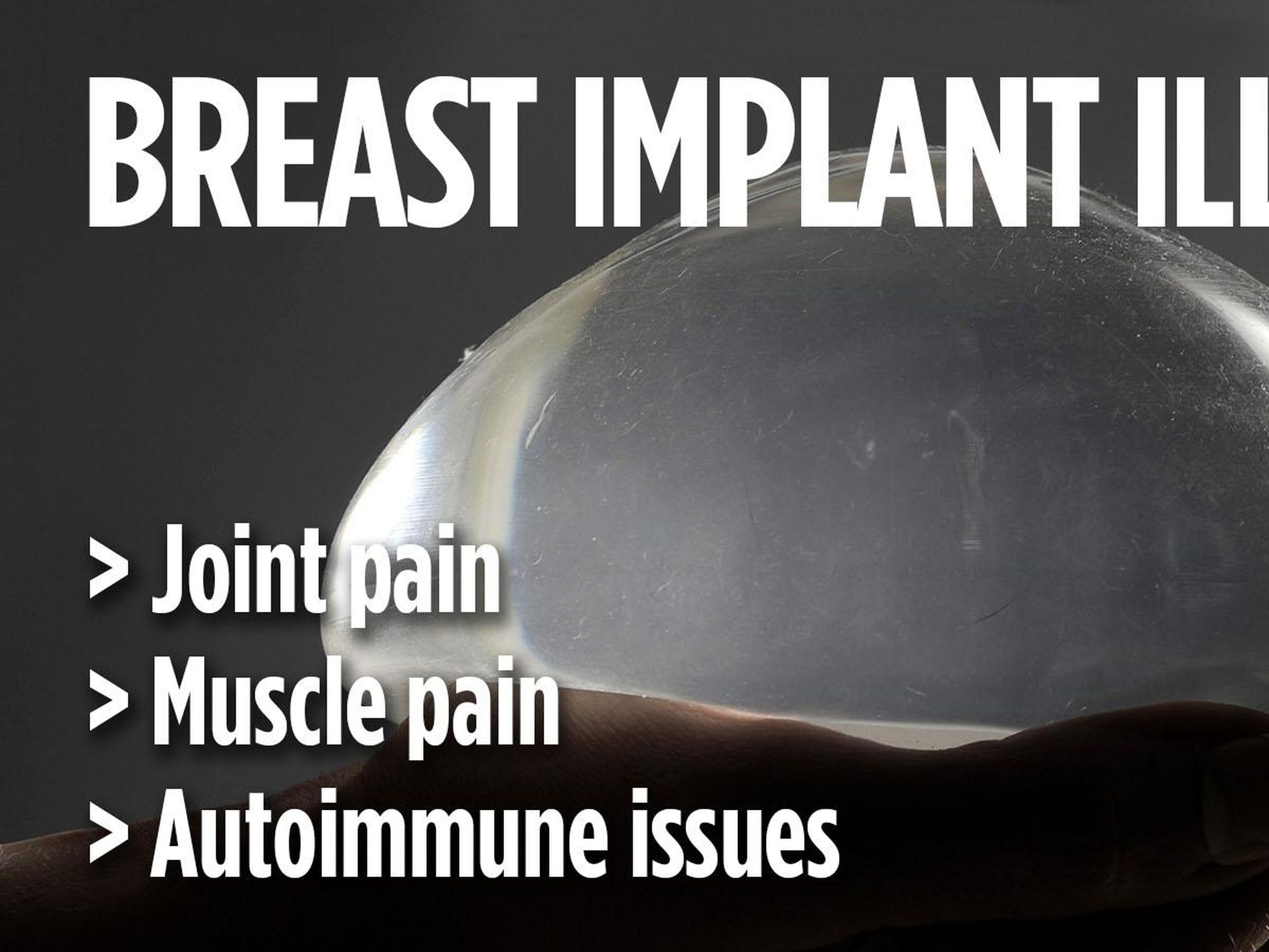 Explanting breast implants Women cite autoimmune ailments The