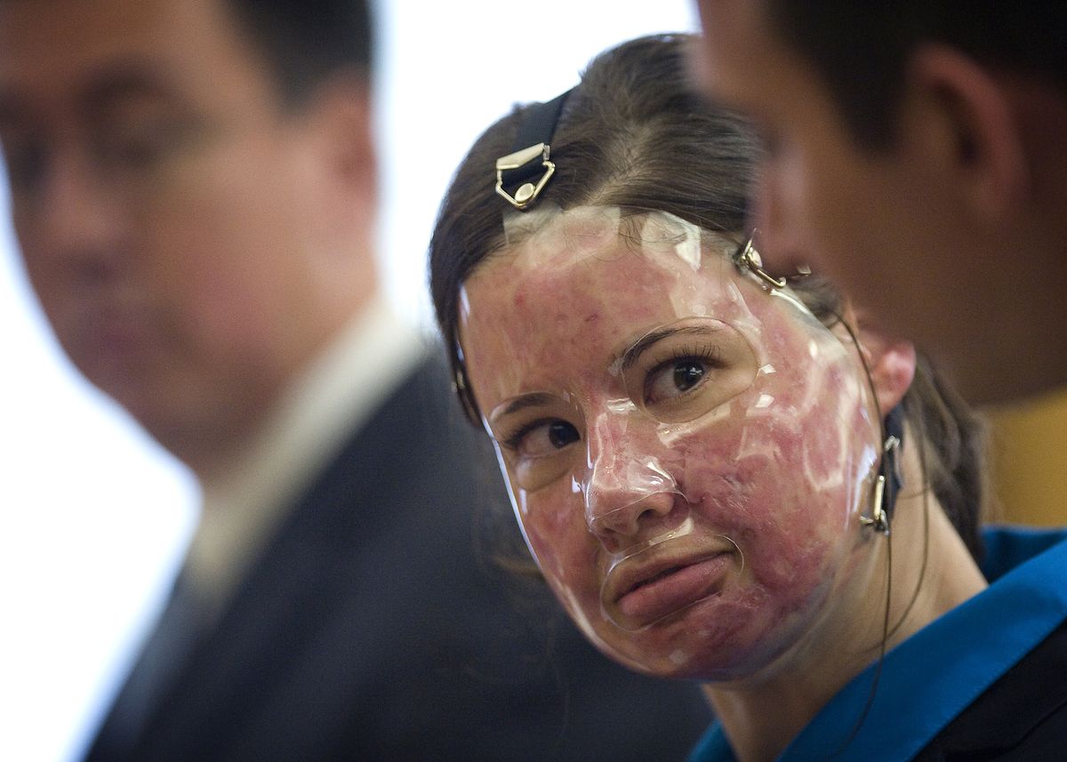 Woman In Acid Attack Hoax Guilty | The Spokesman-Review