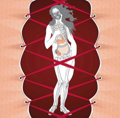 300 dpi 5 col x 9.5 in / 246x241 mm / 837x821 pixels Marie Guglielmo color illustration of a dying Venus with an exposed skeleton and digestive system trapped within the straps of a corset. Wilkes-Barre Times Leader 2002 <p> KEYWORDS: diet eating disorder health medicine anorexia nervosa bulemia skeleton body image women illustration salud medicina mujer comer desorden esqueleto cuerpo ilustracion grabado contributed wb guglielmo 2002 health (Marie Guglielmo / Marie Guglielmo/Wilkes-Barre Times Leader)