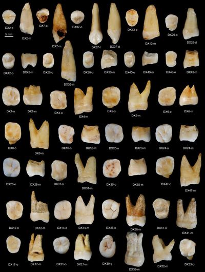 This photo provided by the journal Nature shows human upper teeth found in the Fuyan Cave of Hunan province in southern China. (S. Xing / Associated Press)