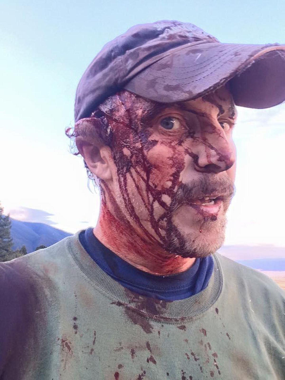 Todd Orr of Bozeman Montana, makes a short video after being mauled by a sow grizzly bear that had two cubs. (Courtesy photo)