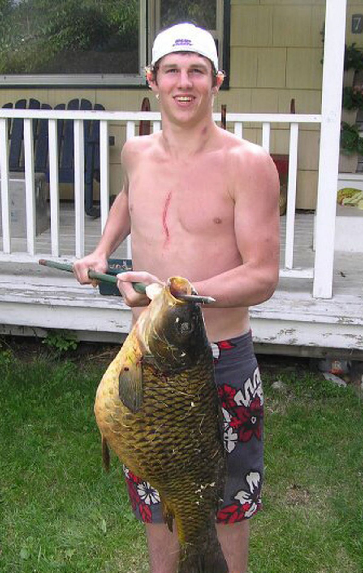 Prior to his injury, Casey McKern shows off a 38-pound carp he speared.