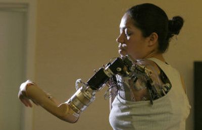 
A first-generation bionic arm 