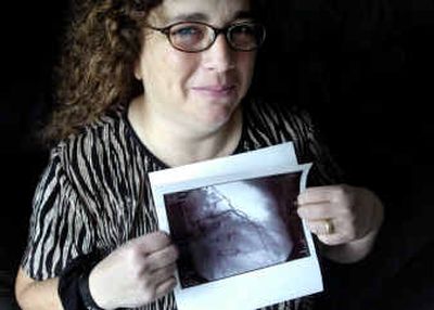 
Cindy Scinto holds an image of her heart taken in 2002. Scinto, who has aggressive heart disease, participated in a clinical trial of a synthetic growth hormone which promotes blood vessel growth. 
 (Holly Pickett / The Spokesman-Review)