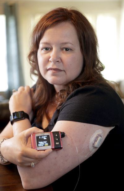 Stephanie Rodenberg-Lewis holds her Animas Corp. insulin pump at her home in Katy, Texas, on June 7, 2016. Her insurance company, UnitedHealth Group Inc., has made a deal with device maker Medtronic that will slash options for diabetics who use the wearable pumps which cost thousands of dollars. (David J. Phillip / Associated Press)