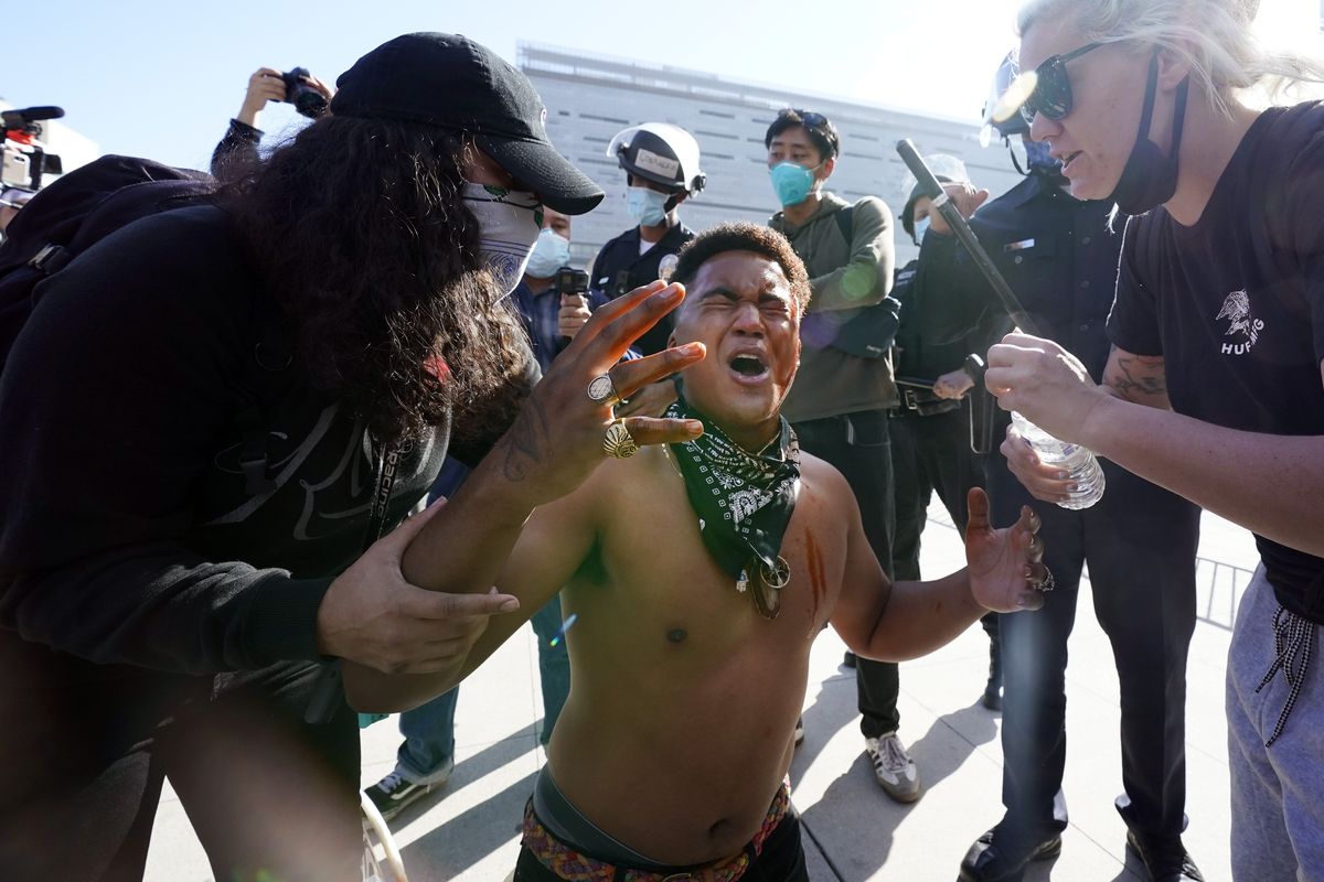 A counter demonstrator, center, yells after getting maced in the face by far-right demonstrators outside of City Hall Wednesday, Jan. 6, 2021, in Los Angeles. Demonstrators supporting President Donald Trump are gathering in various parts of Southern California as Congress debates to affirm President-elect Joe Biden