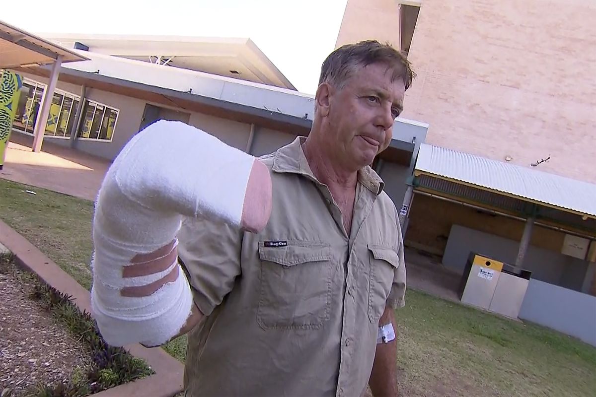 In this image made from a video, Australian wildlife tour operator Sean Dearly is interviewed in Darwin, Australia Tuesday, Sept. 28, 2021. Dearly said he was lucky to escape more serious injury or even death when a crocodile lunged from a river and clamped his hand in its jaws. Dearly was attacked on Monday on the Adelaide River which is renowned for its “jumping crocodiles,” large crocodiles that rise vertically from the water to snatch chicken carcasses dangled from long poles extended from tourist cruise boats.  (TEL)