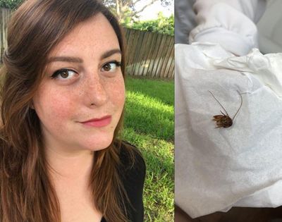 Katie Holley, 29, of Melbourne, Fla., said a palmetto bug crawled into her ear, and much of the insect’s remains stayed there for nine days. (Courtesy of Katie Holley)