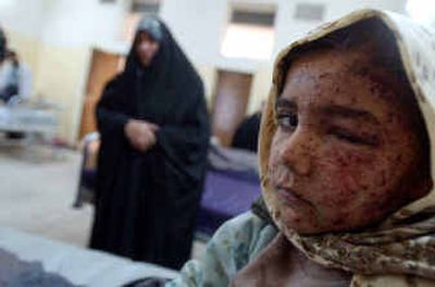 
A young Iraqi girl injured in Sunday's car-bomb blast in the Shiite holy city of Najaf sits in a hospital on Monday. The bomb blast during a funeral killed at least 54 people and wounded 142. 
 (Associated Press / The Spokesman-Review)