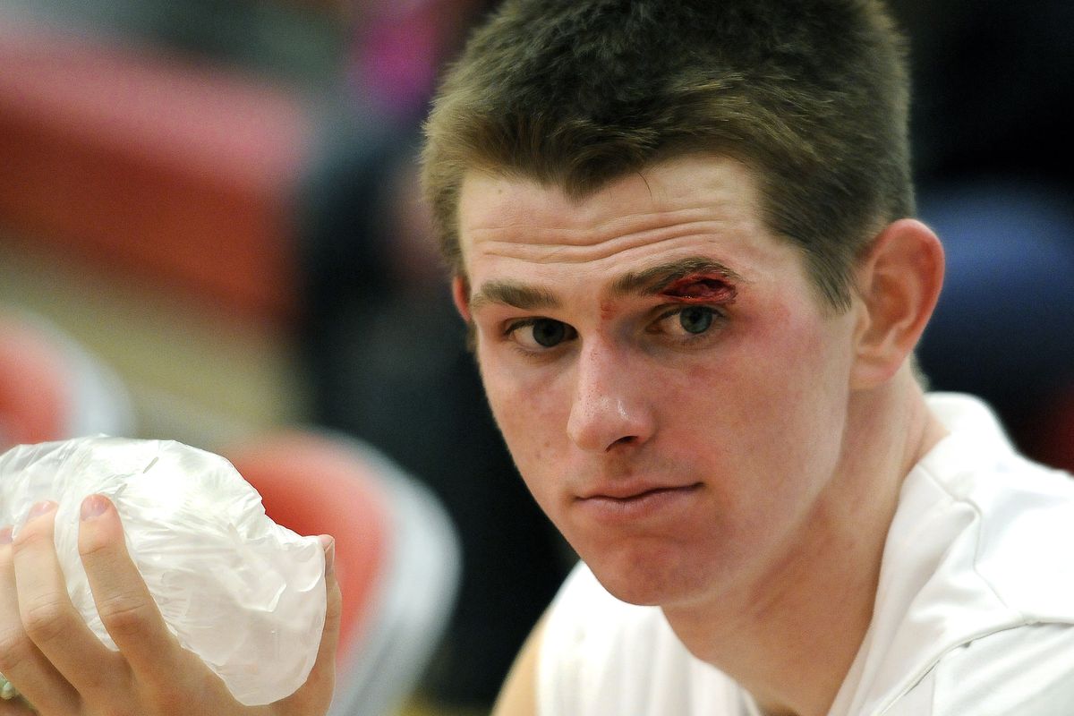 Ferris guard Riley Stockton was forced to leave the game against North Central after suffering a gouge over his eye when he hit the floor in the fourth quarter. (Dan Pelle)
